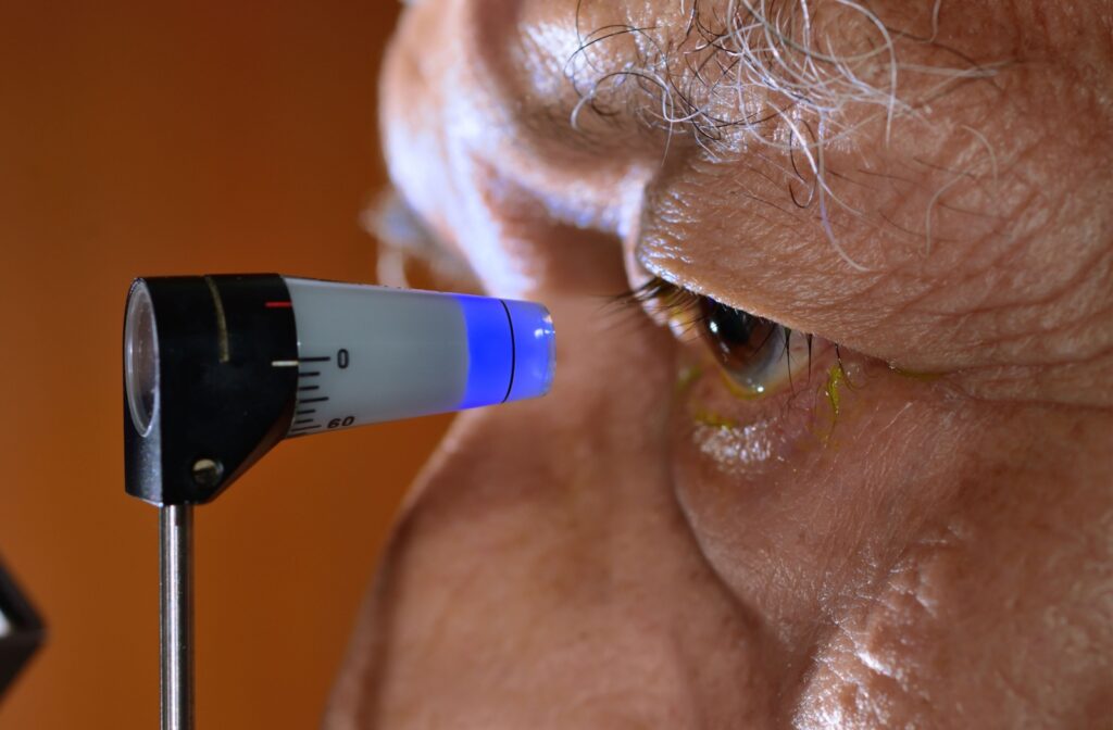 Close-up of a tonometry device in front of an eye. Tonometry device looks like a glowing stick with measurements.